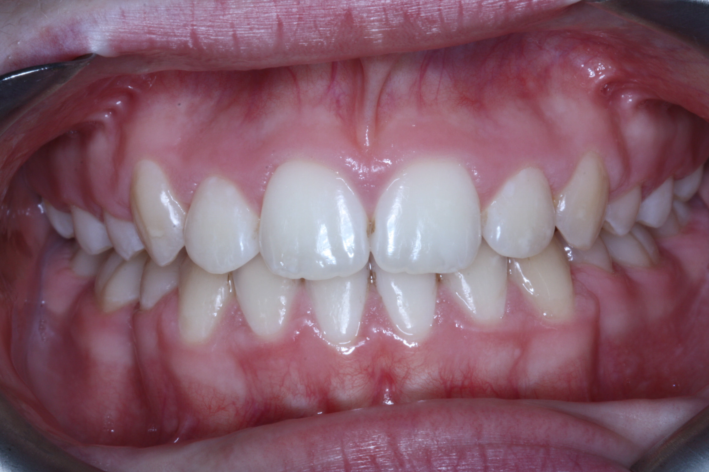 Why Orthodontics Matters Swords Dublin Swords Orthodontics