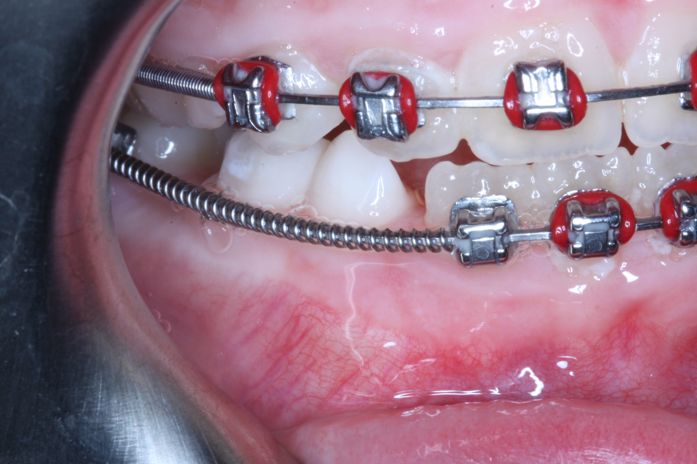 Swords Dublin Orthodontist Services & Procedures Orthodontist IE