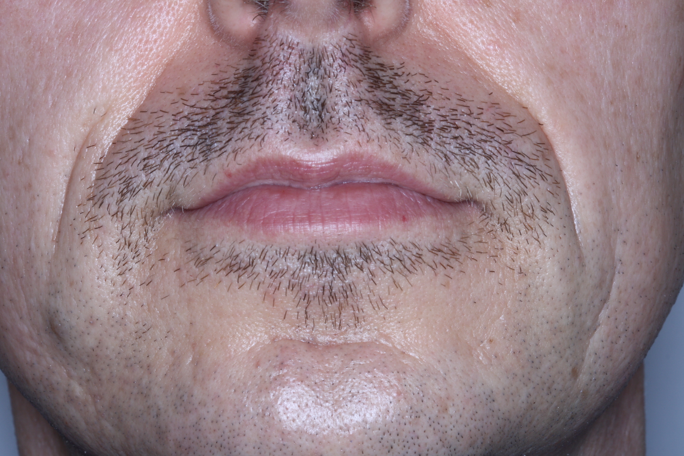 Dr Stephen Murray of Swords Orthodontics is helping Men's Health by participating in Movember