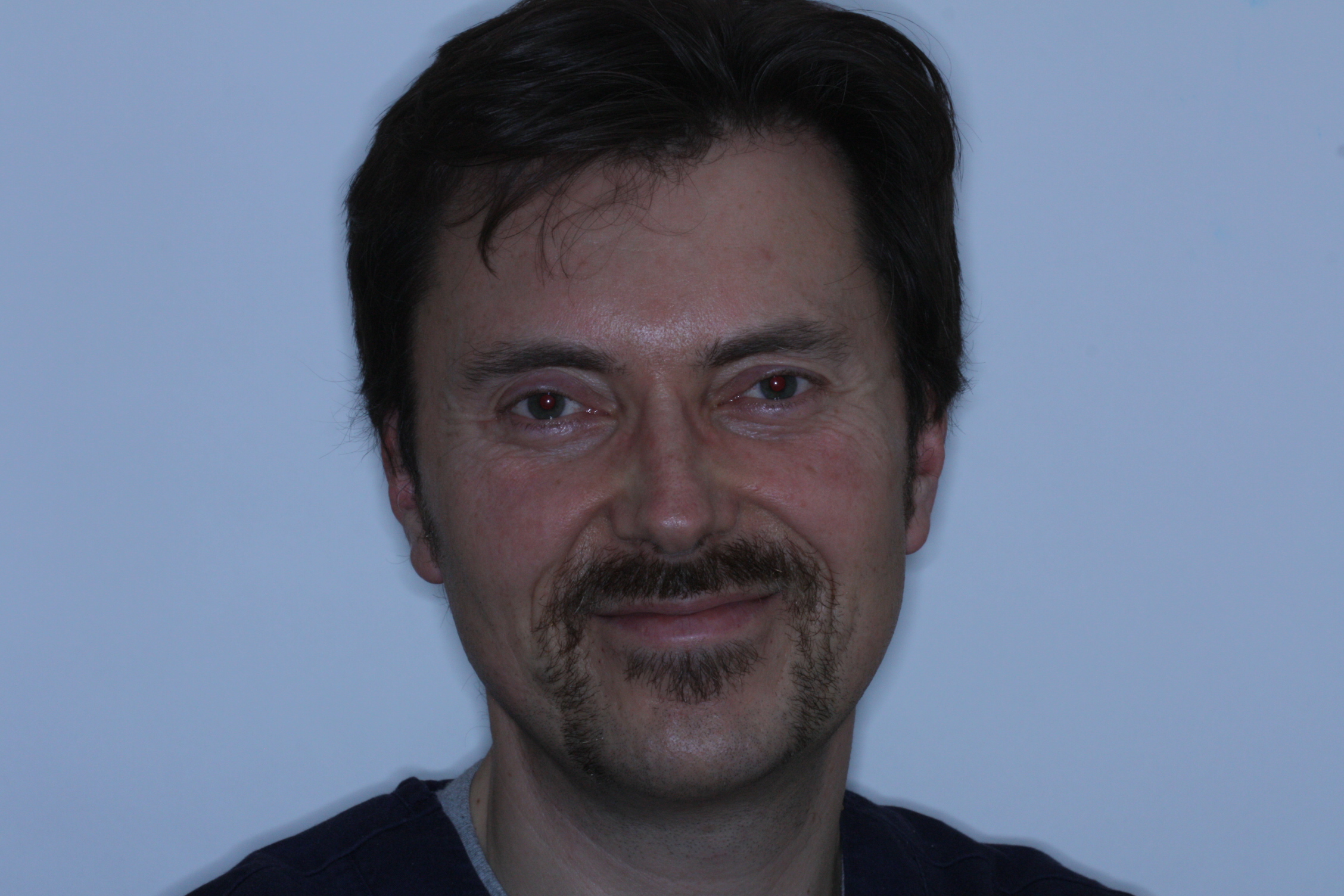 Movember 25th for Dr Stephen Murray of Swords Orthodontics