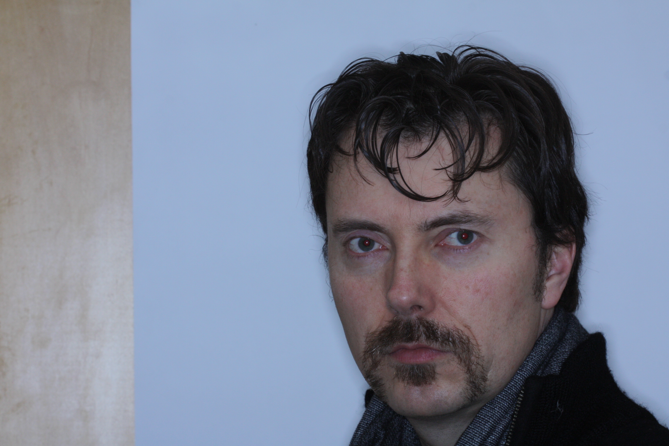 Movember's End for Dr Stephen Murray of Swords Orthodontics