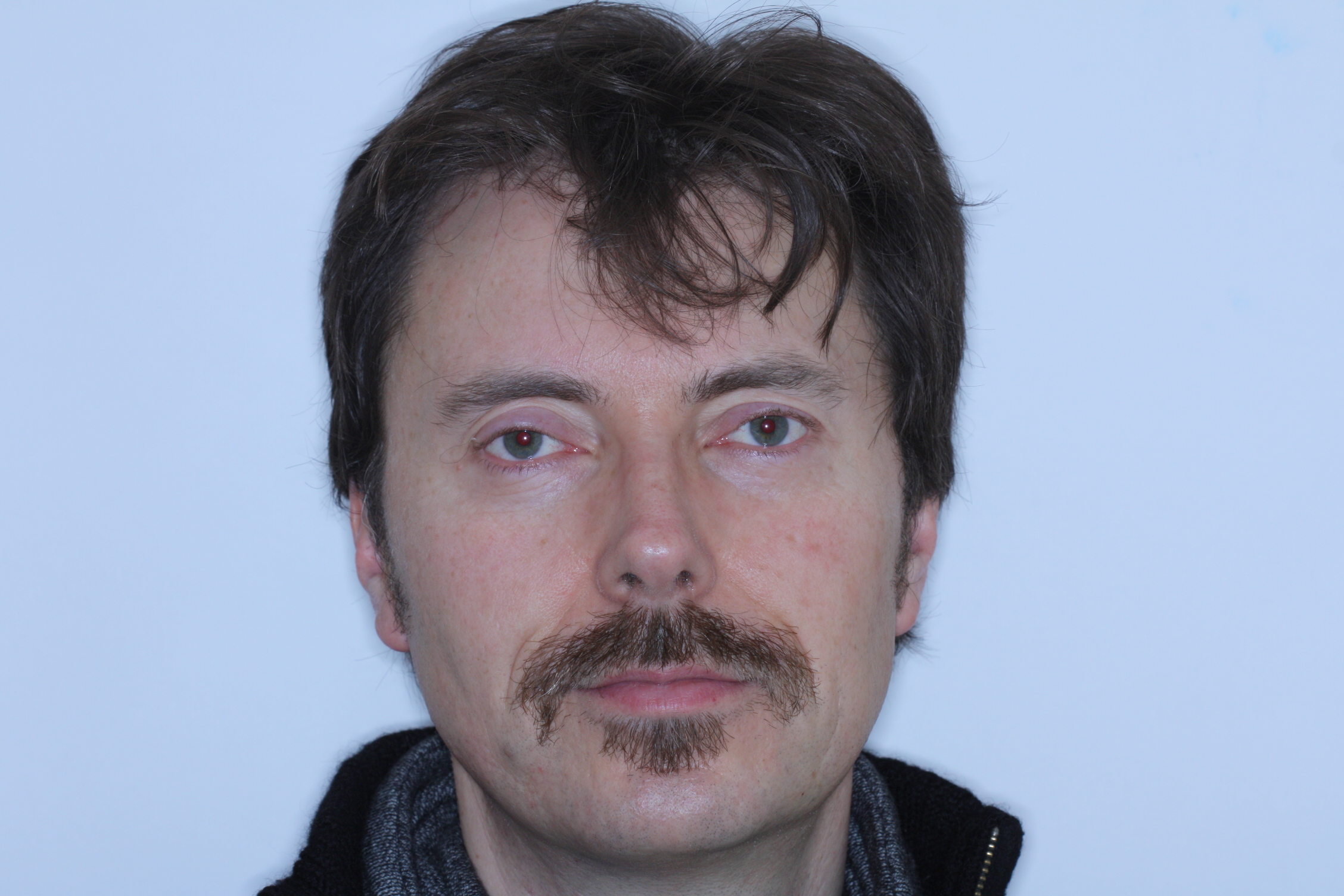 Dr Stephen Murray from Swords Orthodontics channels his inner Frank Zappa before finally removing the Movember evidence