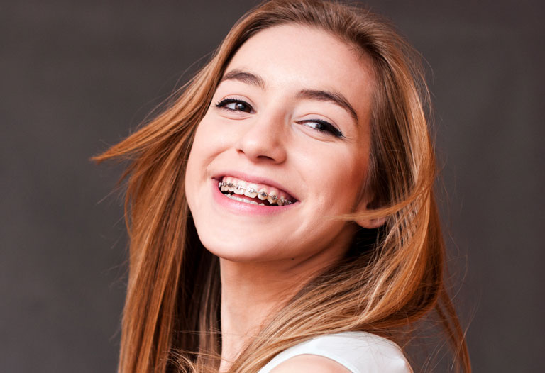 Swords Orthodontics | Teens