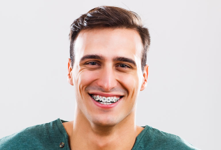 Swords Orthodontics | Fixed Braces